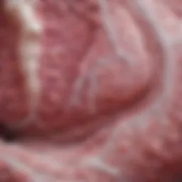 Histological examination of acinar adenocarcinoma tissues showcasing cellular characteristics