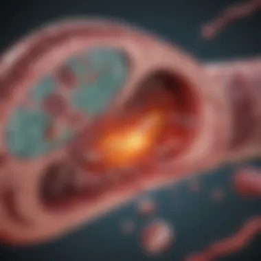 Diagram depicting the pathophysiology of acute cholecystitis Acute cholecystitis pathology
