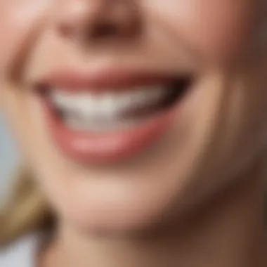 Teeth Whitening Results: Before and After Before and after comparison of teeth whitening results