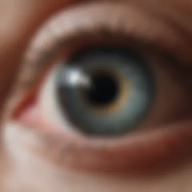 Understanding Cataract Development Visual representation of the cataract formation process
