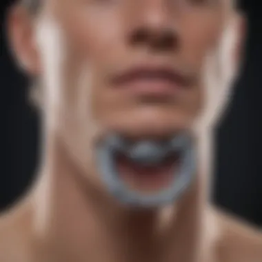 Cervical Plate Placement Technique Surgical illustration depicting cervical plate placement