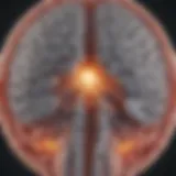 Illustration showing the brain's anatomy with DBS placement