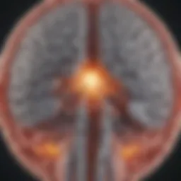 Illustration showing the brain's anatomy with DBS placement