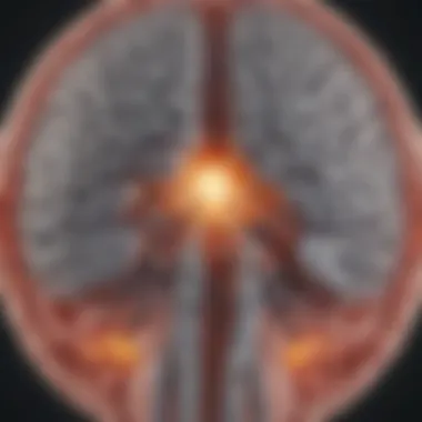 Anatomical Overview of Deep Brain Stimulation in Parkinson's Disease Illustration showing the brain's anatomy with DBS placement