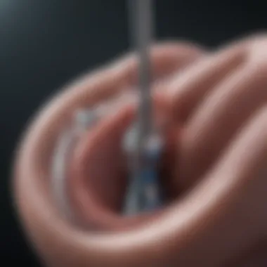 Surgical Interventions for Bladder Implants Surgical procedure for bladder implant placement