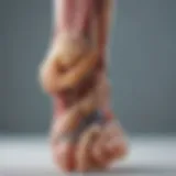 Illustration representing the anatomical structure of a foot with clubfoot deformity