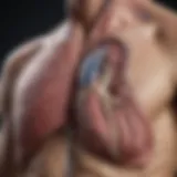 Detailed diagram illustrating lung hernia anatomy