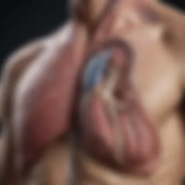 Anatomy of Lung Hernia Detailed diagram illustrating lung hernia anatomy