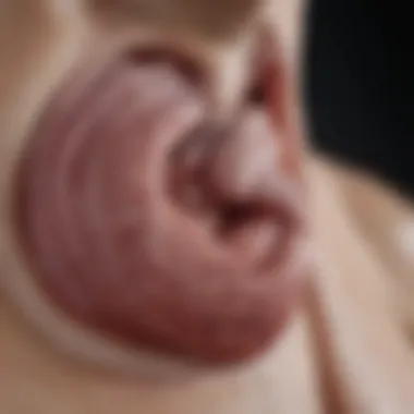 Recent Research on Lung Hernias Latest research findings on lung hernias in graphical format