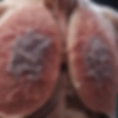 Lung Infection Representation Induced by Klebsiella pneumoniae Illustration of lung infection caused by bacteria