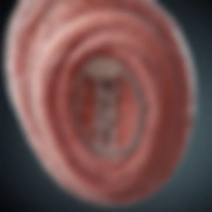 Clinical application of nitinol stents in cardiovascular procedures highlighting their efficacy.