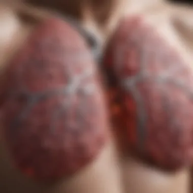 Connection Between Lung Cancer and Pulmonary Fibrosis Illustration depicting the relationship between lung cancer and pulmonary fibrosis.
