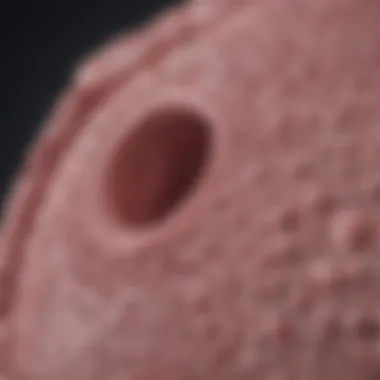 Treatment Challenges of Recurrent DCIS Challenges faced in treating recurrent ductal carcinoma in situ.