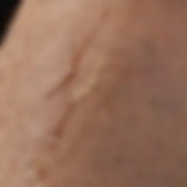 Diverse Types of Scars Explained Visual representation of different scar types