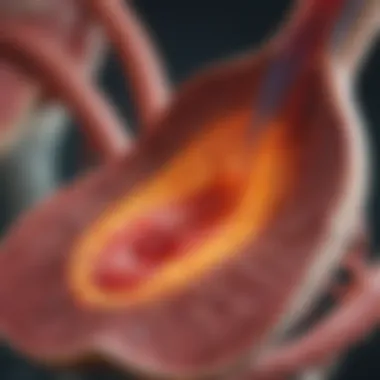 Diagram illustrating the pathophysiology of Acute Kidney Injury
