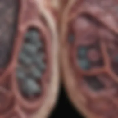 Comparison of benign and malignant lung nodules