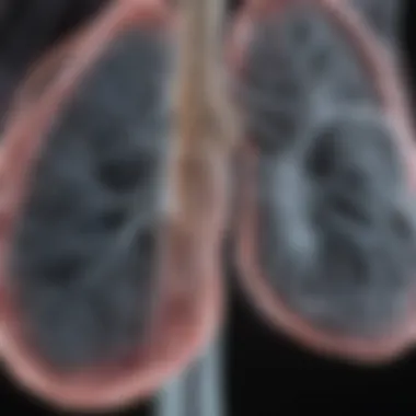 Characteristics of Lung Nodules on X-Ray Radiographic view of lung nodules highlighting their characteristics