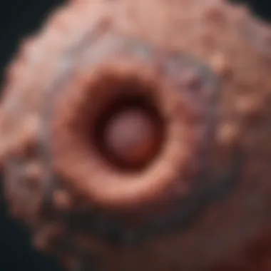 Pathological Representation of Squamous Cell Carcinoma Pathological representation of squamous cell carcinoma