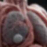 Radiographic view of lung cancer progression